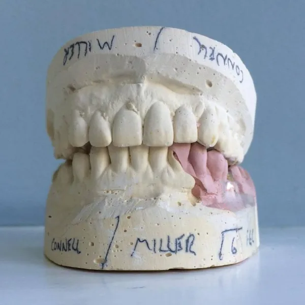 The howtocuredyslexiaband - Teeth